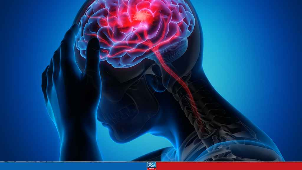 One in Four People at Risk of Stroke: Expert Physicians Discuss Global Burden