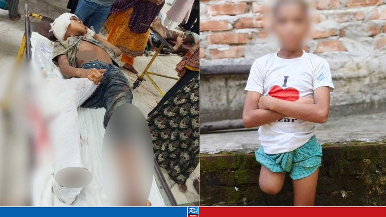 শিশু রায়হানের পা কাটা নিয়ে বেরিয়ে এলো চাঞ্চল্যকর তথ্য