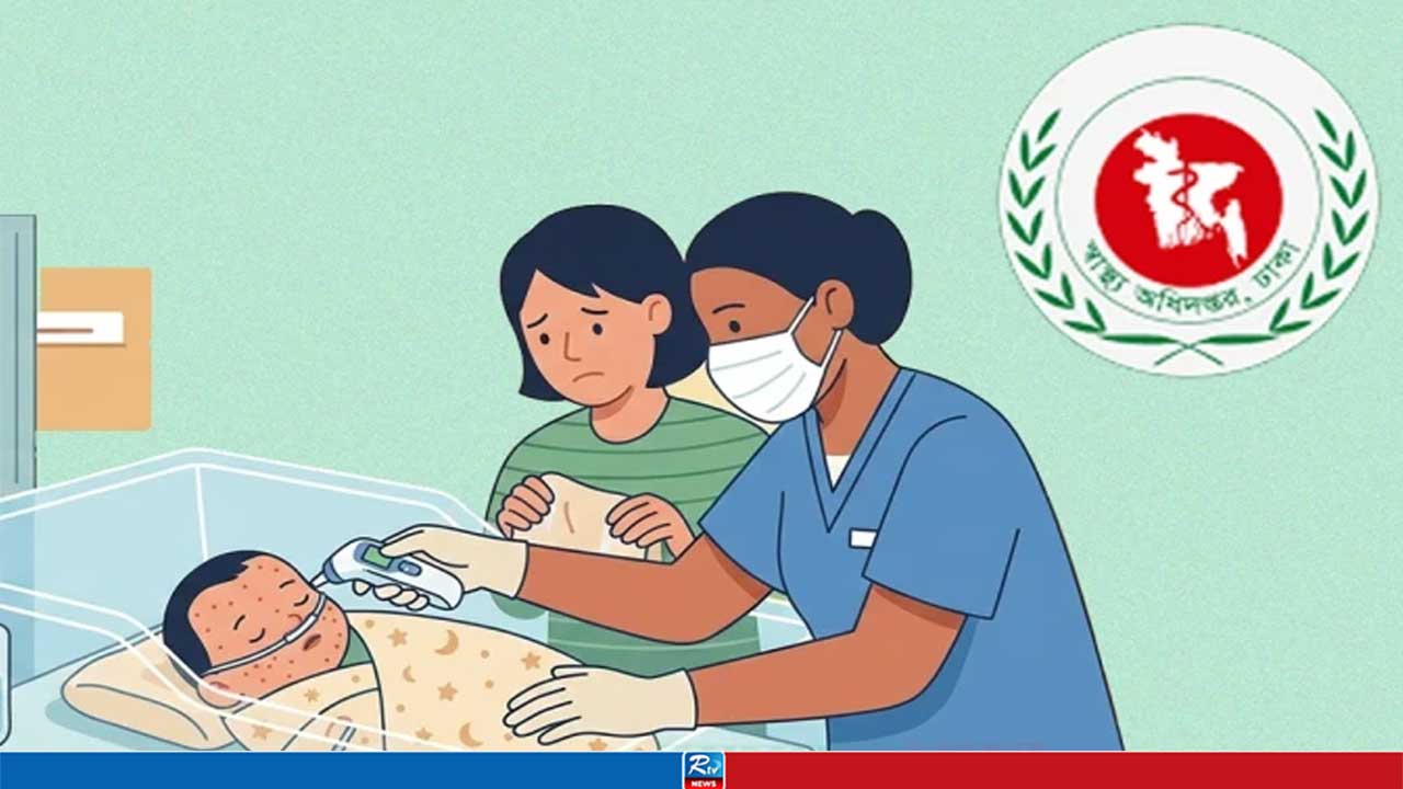 হামের উপসর্গ নিয়ে আরও ৫ শিশুর মৃত্যু