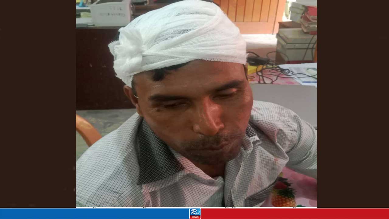 নেশার টাকা না পেয়ে ইট দিয়ে বাবার মাথা ফাটালেন ছেলে