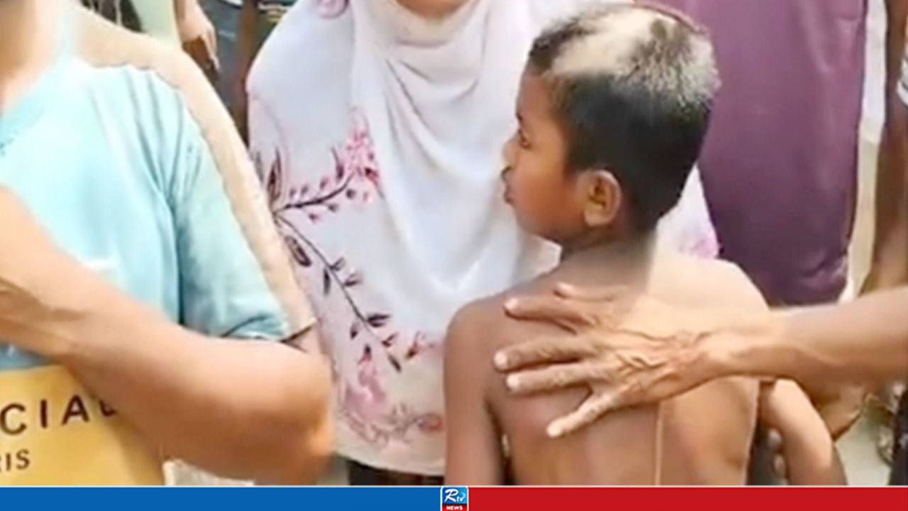 ২০ টাকা চুরির অপবাদে শিশুকে বেধড়ক পেটালেন মাদরাসাশিক্ষক