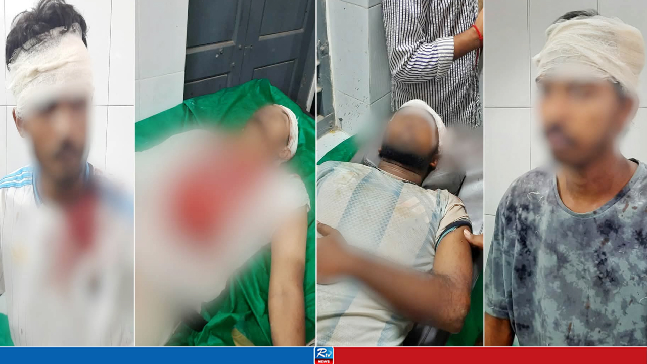 তুমুল মারামারিতে রণক্ষেত্র নজরুল বিশ্ববিদ্যালয়, হাসপাতালে ভর্তি ৬
