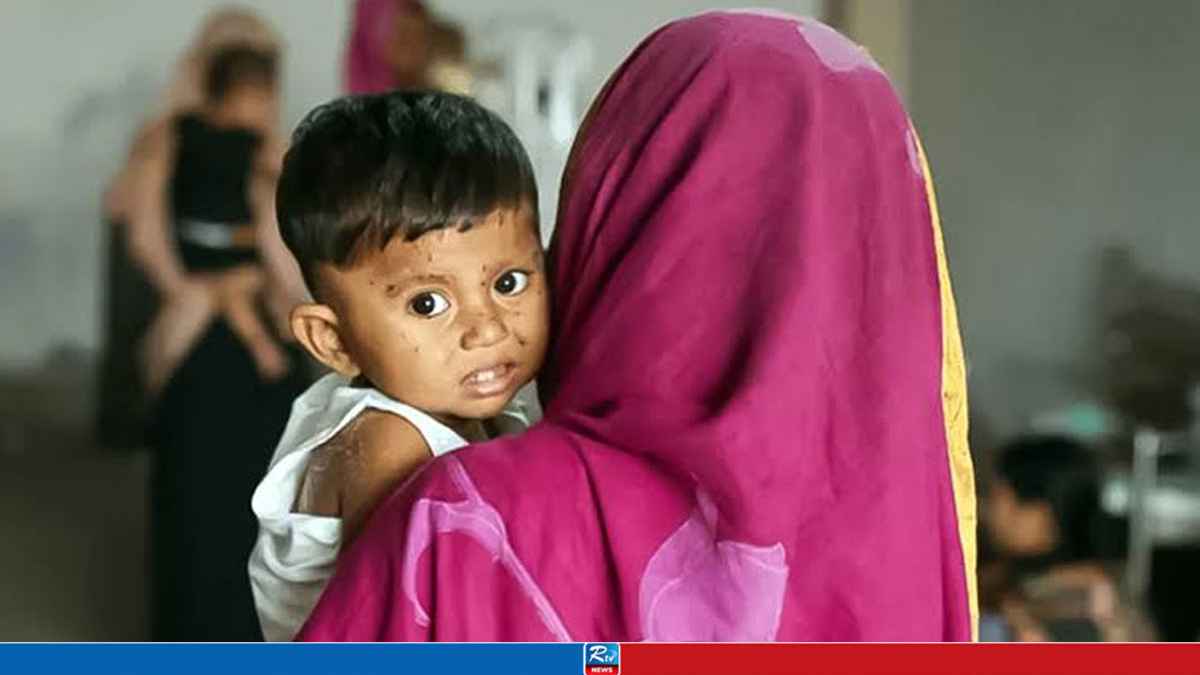 হামের উপসর্গ নিয়ে আরও তিন শিশুর মৃত্যু, মোট প্রাণহানি ৮৪০