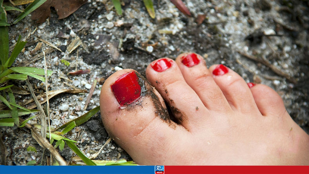 কাদায় পা দিলেই নখে সংক্রমণ? যত্ন নেবেন যেভাবে