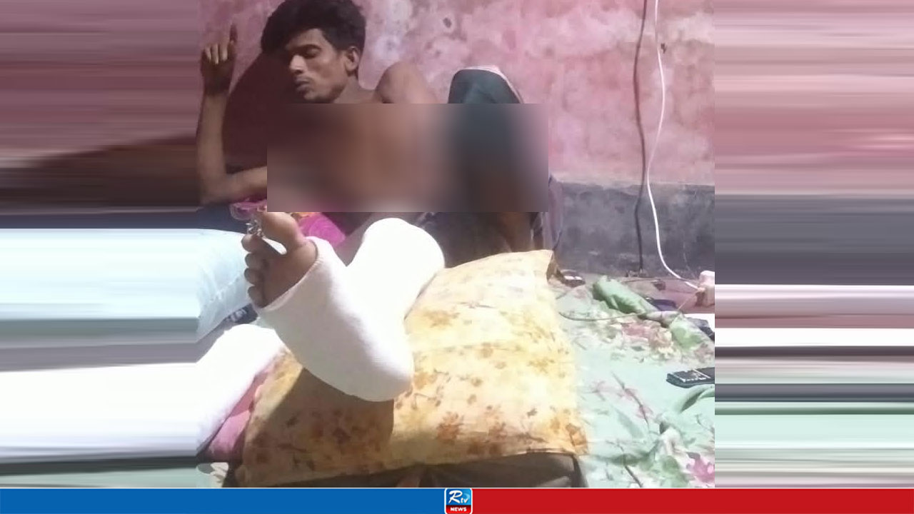 লোহার আঘাতে পা ভাঙার পরও মেলেনি চিকিৎসা, বিপাকে শ্রমিক