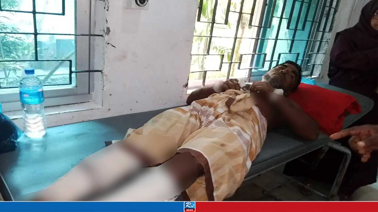 মনপুরায় ইউপি সদস্যের হাত-পা ভেঙে দিল দুর্বৃত্তরা