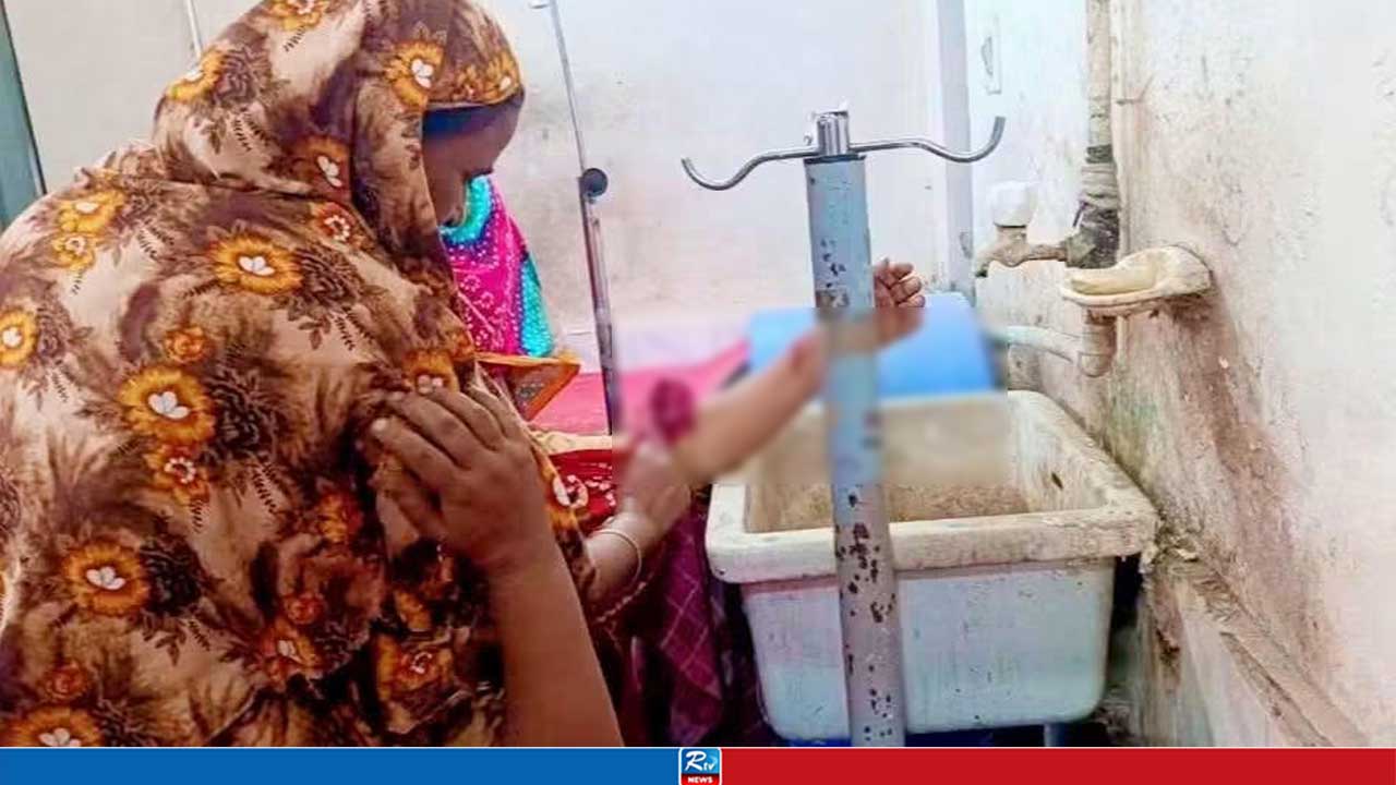 হিলিতে শিয়ালের কামড়ে নারী-শিশুসহ আহত ৮