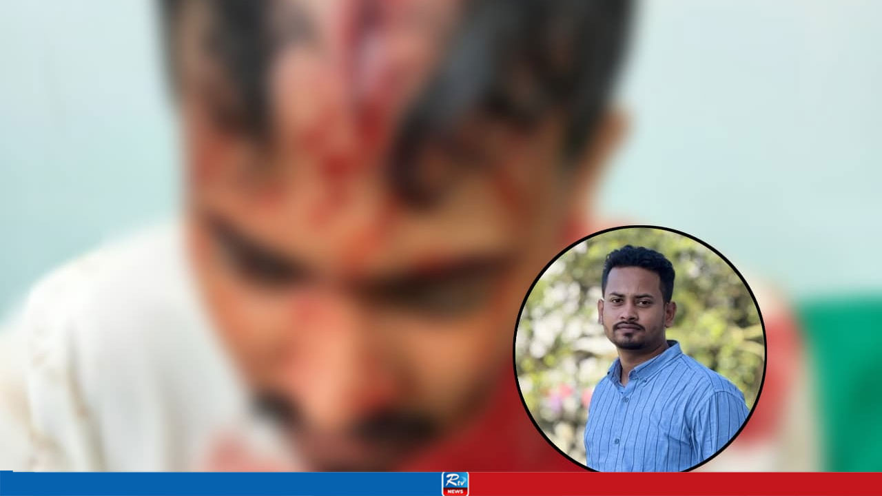 ‘জ্ঞান হারানোর পরও রড-স্ট্যাম্প দিয়ে পেটায়, আমার পরিচিত মুখগুলোই আমাকে আঘাত করছিল’